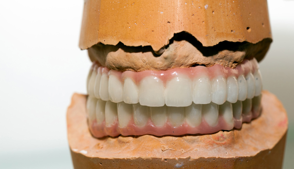 Common Questions About Denture Repair